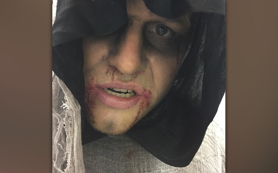 Olly Murs könnte ohne Probleme als hauptberuflicher Horrordarsteller durchgehen.